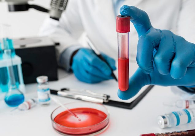 Що таке ШОЕ в аналізі крові і що це означає?