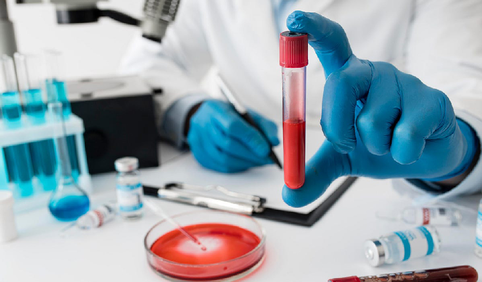 Що таке ШОЕ в аналізі крові і що це означає?