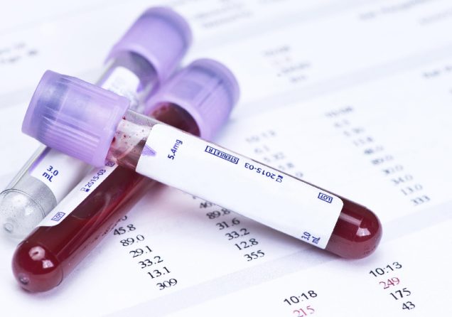 Що показує загальний аналіз крові і про що можуть свідчити його результати?