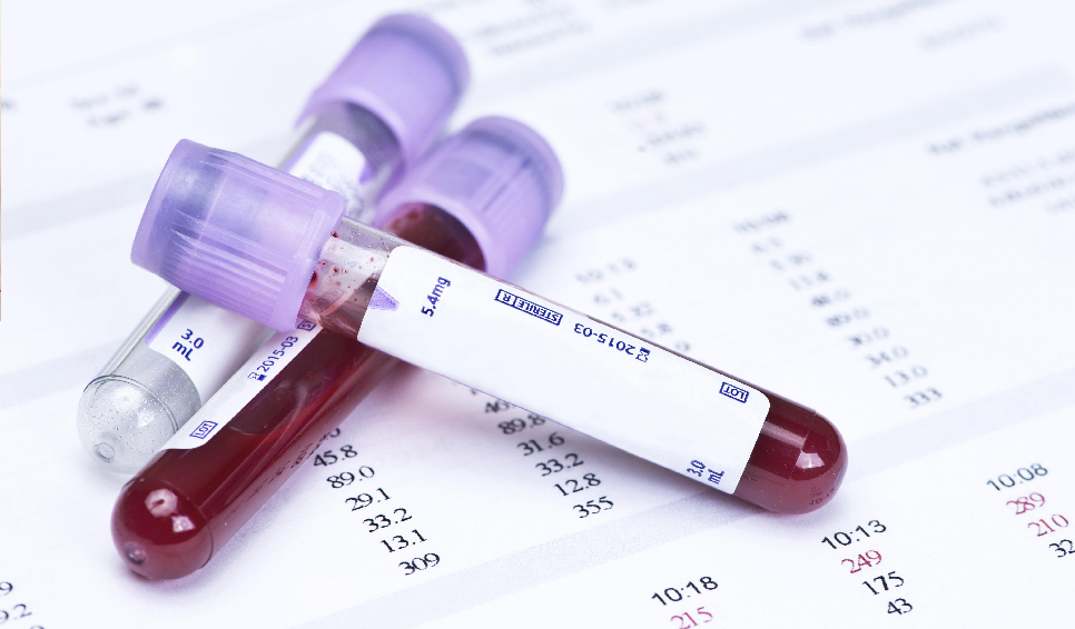 Що показує загальний аналіз крові і про що можуть свідчити його результати?