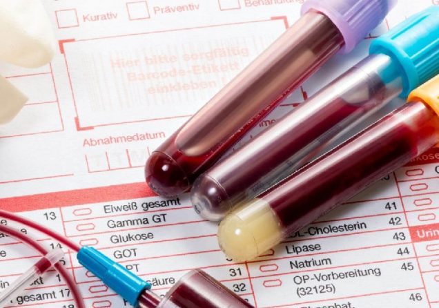 Біохімія крові: які показники входять до аналізу та що вони означають?