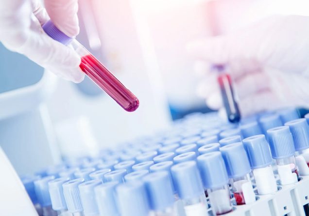 Чому результати в різних лабораторіях відрізняються? Правда, яку вам не розповідали