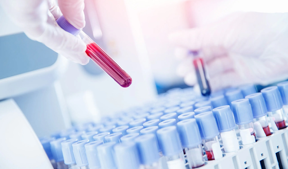 Чому результати в різних лабораторіях відрізняються? Правда, яку вам не розповідали