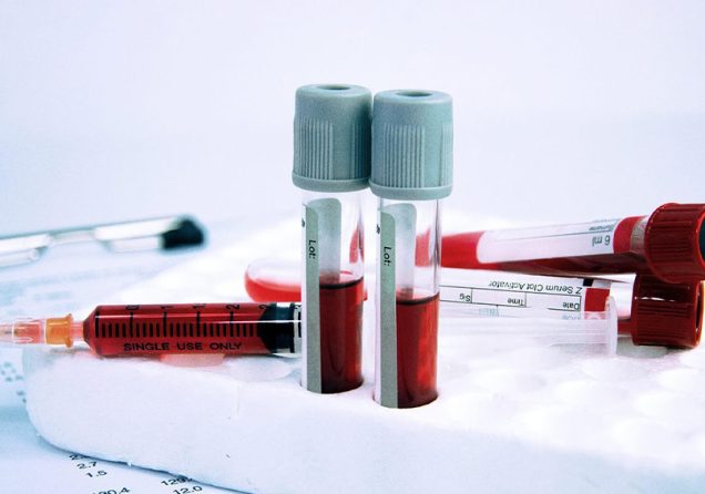 Підготовка до загального аналізу крові