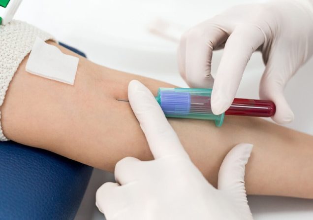 Які аналізи потрібно здавати в профілактичних цілях?