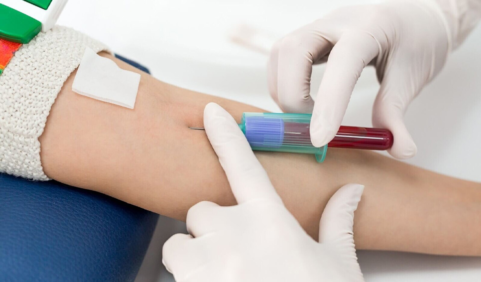 Які аналізи потрібно здавати в профілактичних цілях?